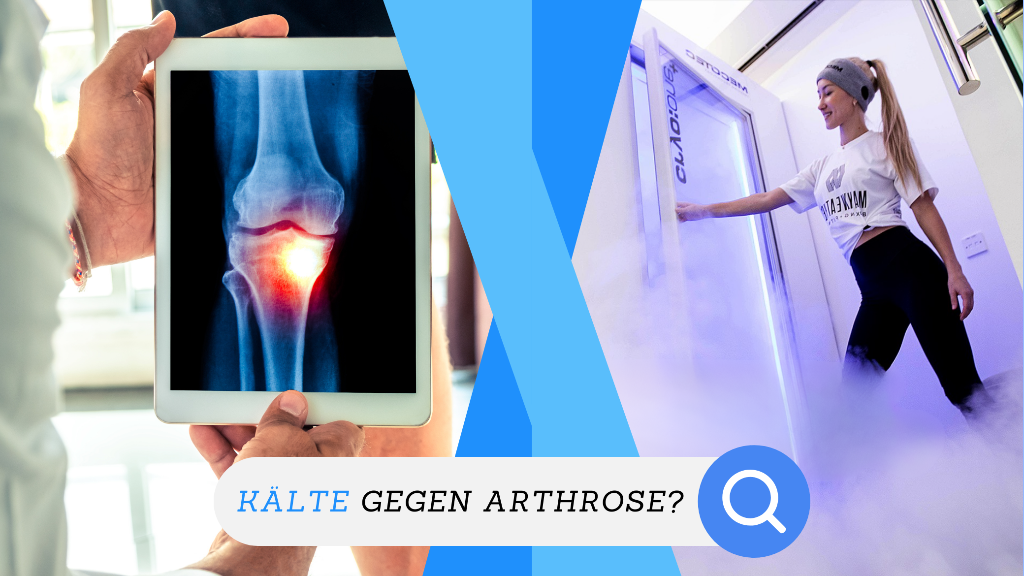 Arthrose.png__PID:f2f776ba-e046-4d29-be89-afac8bca3417